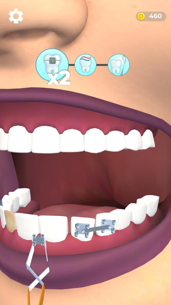 假牙医生-图3